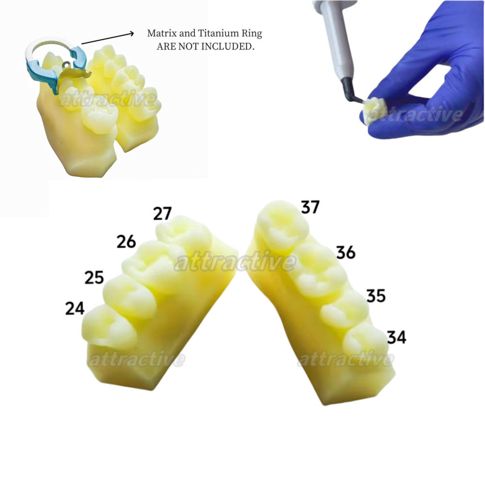Dental Caries Decay Teeth Model Composite Resin Restore Tooth Simulate Class Ⅱ