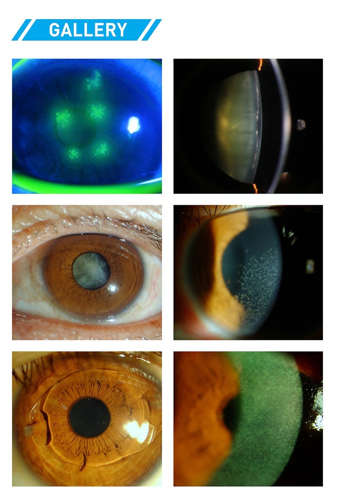 Five times magnification ophthalmic slit lamp optometry microscope