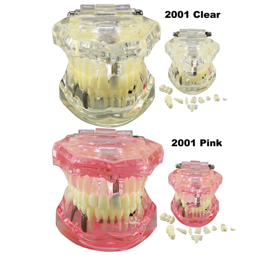 Dental Ortho Teeth Model Implants Practice Teaching Restortion Brushing Model