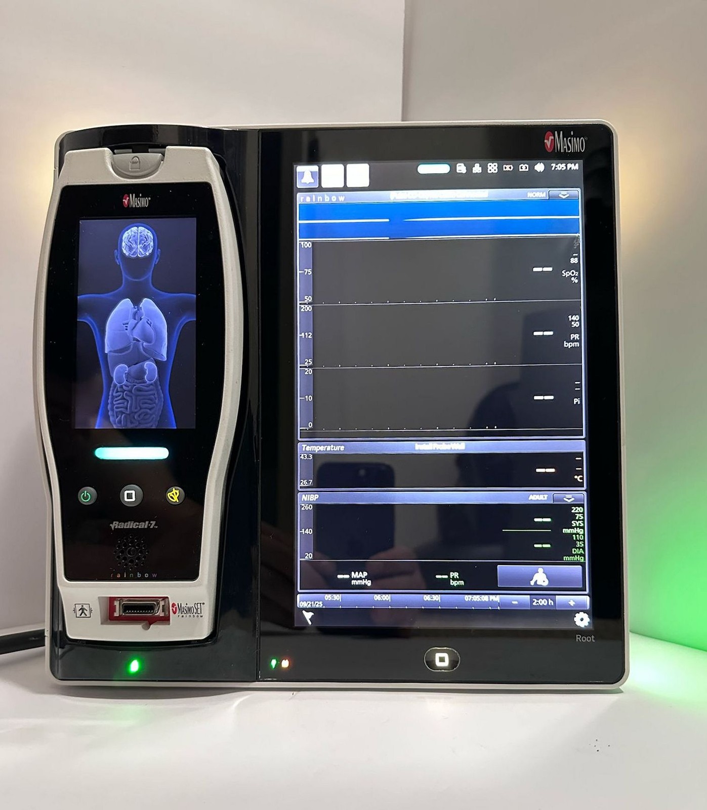 Masimo RDS7A Root Monitor with Masimo Radical 7 Pulse Oximeter