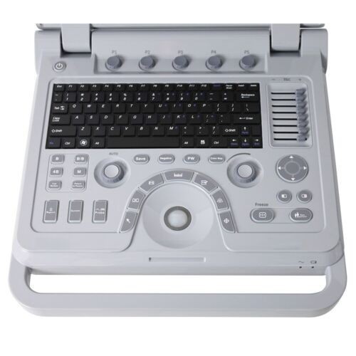 Portable Color Doppler Ultrasound Scanner Machine DiagnosticSystem Convex Linear