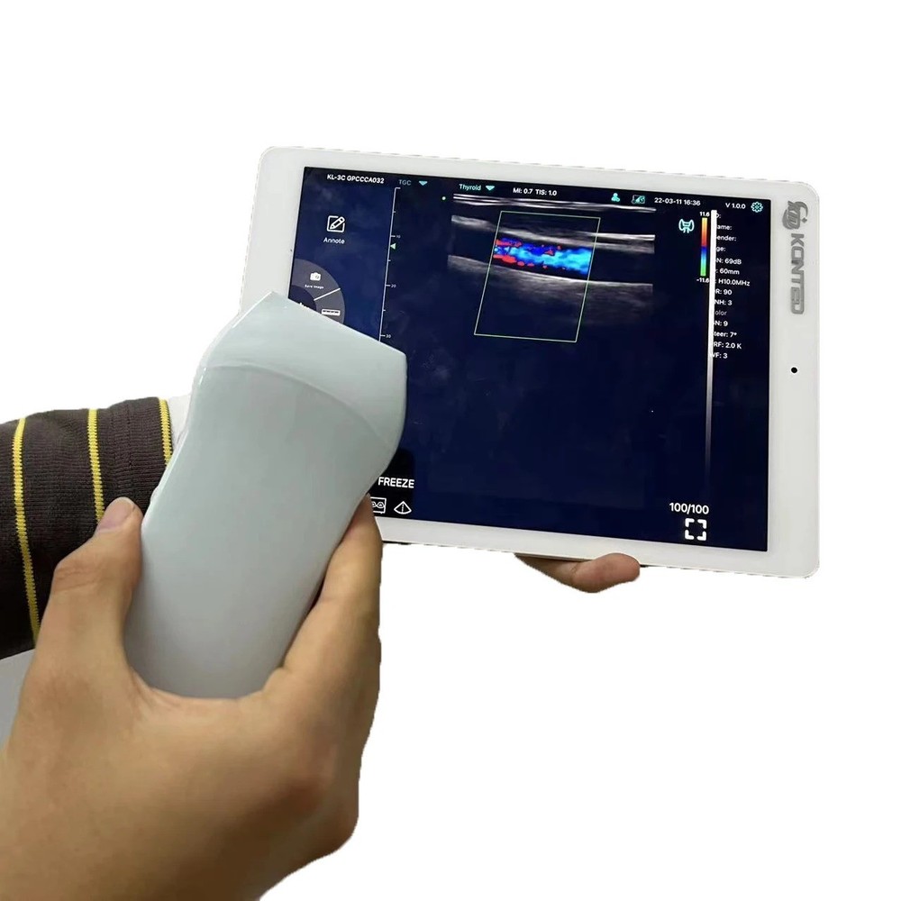 Portable Wireless Ultrasound Scanner - HD Linear Array Color Doppler