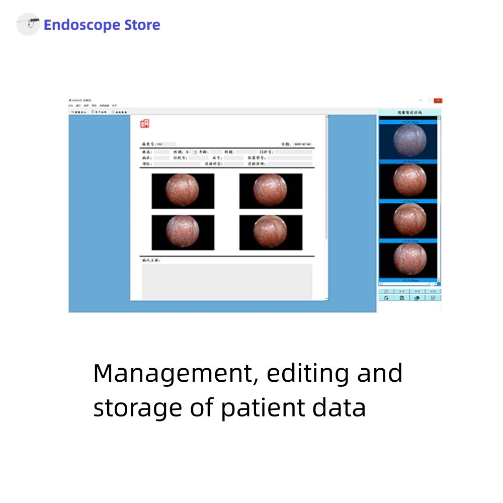 HD 1080P USB Endoscope Camera With LED Light Source ENT Examination Veterinary