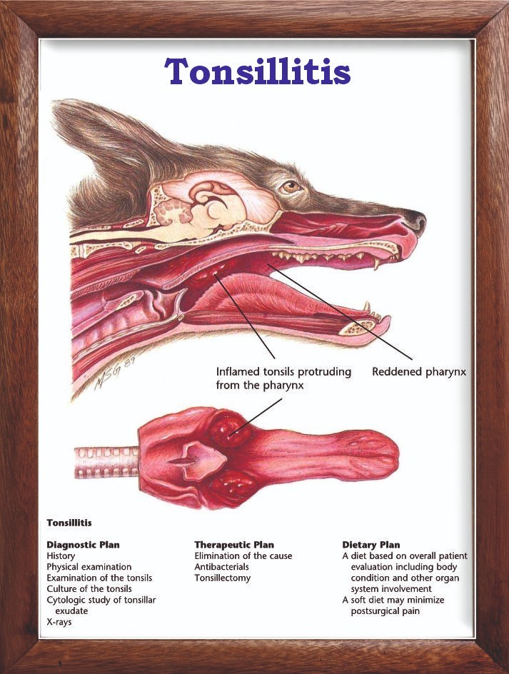 Tonsillitis Chart 12x18 inches