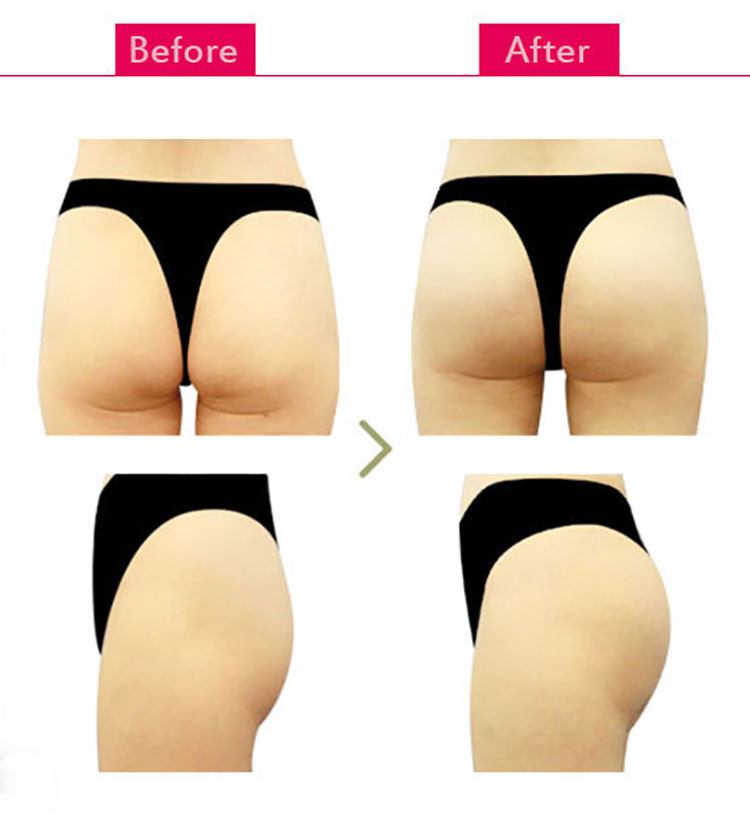 Breast Butt Enlargement Enhancement Cream Euro Cleavage Firming Lifting Tighten