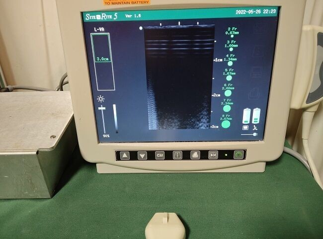 BARD Site Rite 5 Vascular 9760036