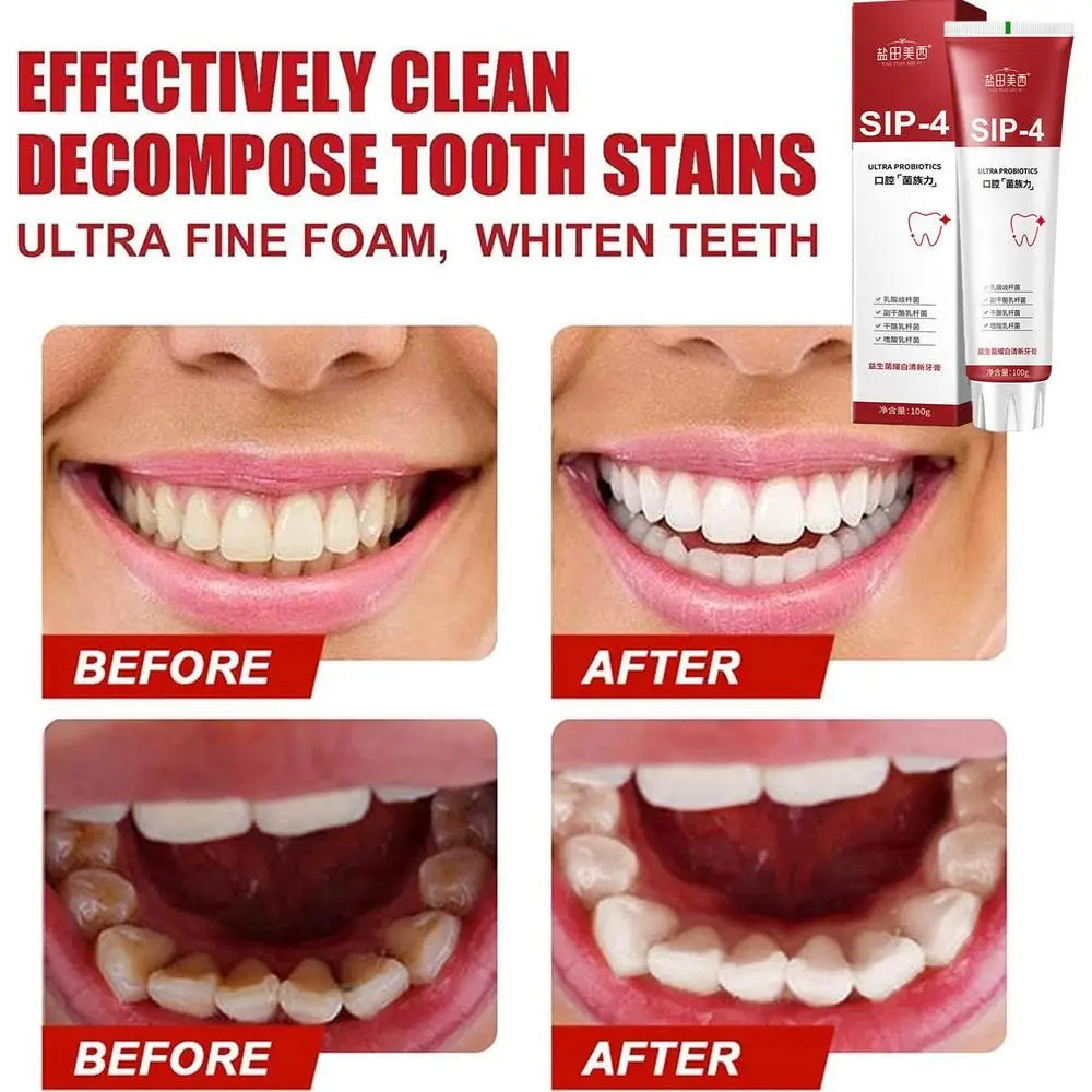 SIP-4 Toothpaste,SIP-4 Tooth Paste, Yayashi SP-4™ Probiotic Whitening Toothpaste