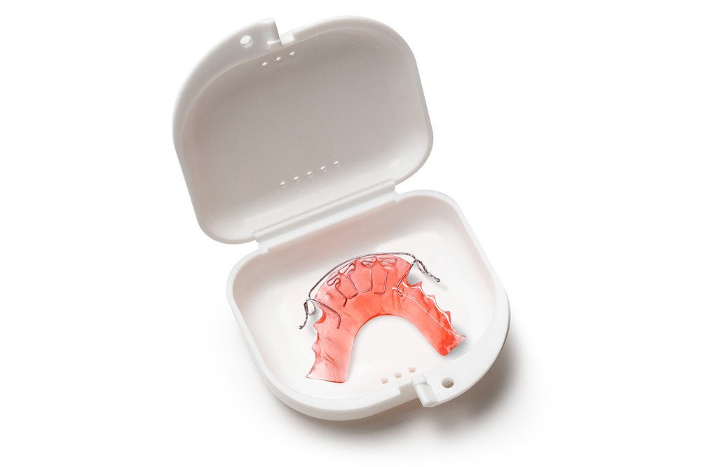 Custom Hawley Spring Retainer and Aligner, Removable, At-Home Dental
