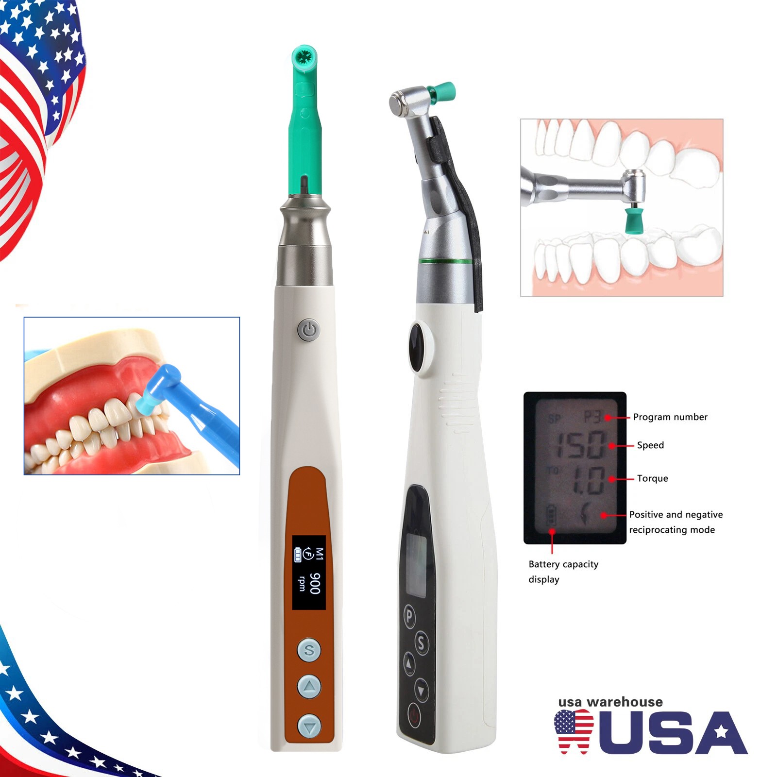 Dental Wireless Hygiene Prophy Handpiece /4:1 Polishing Prophy Motor Handpiece