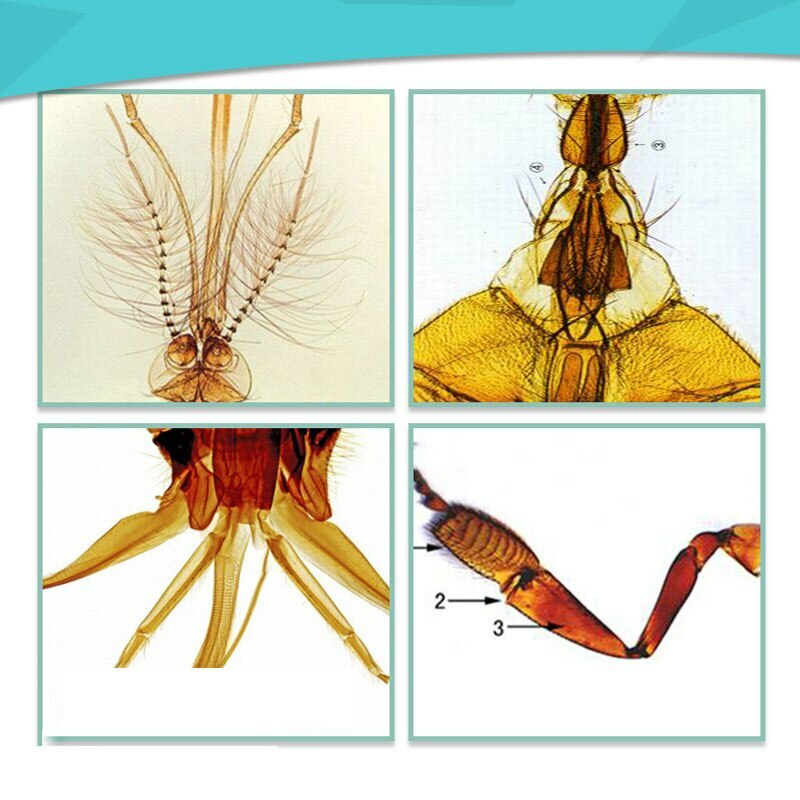 Glass Microscope Prepared Slides Set for Lab Biology Study 25PCS