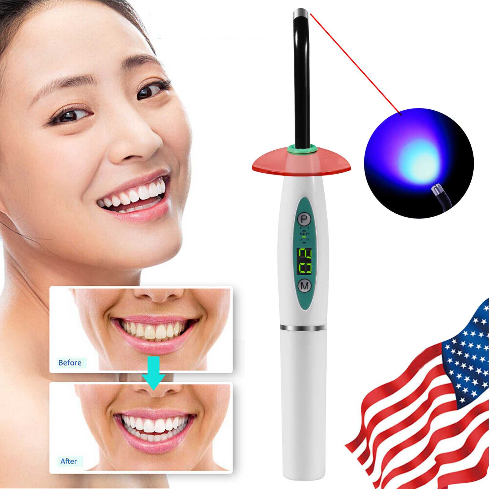 Dental LED Curing Light Lamp Wireless Cordless Resin Cure 5W 2000MW FDA