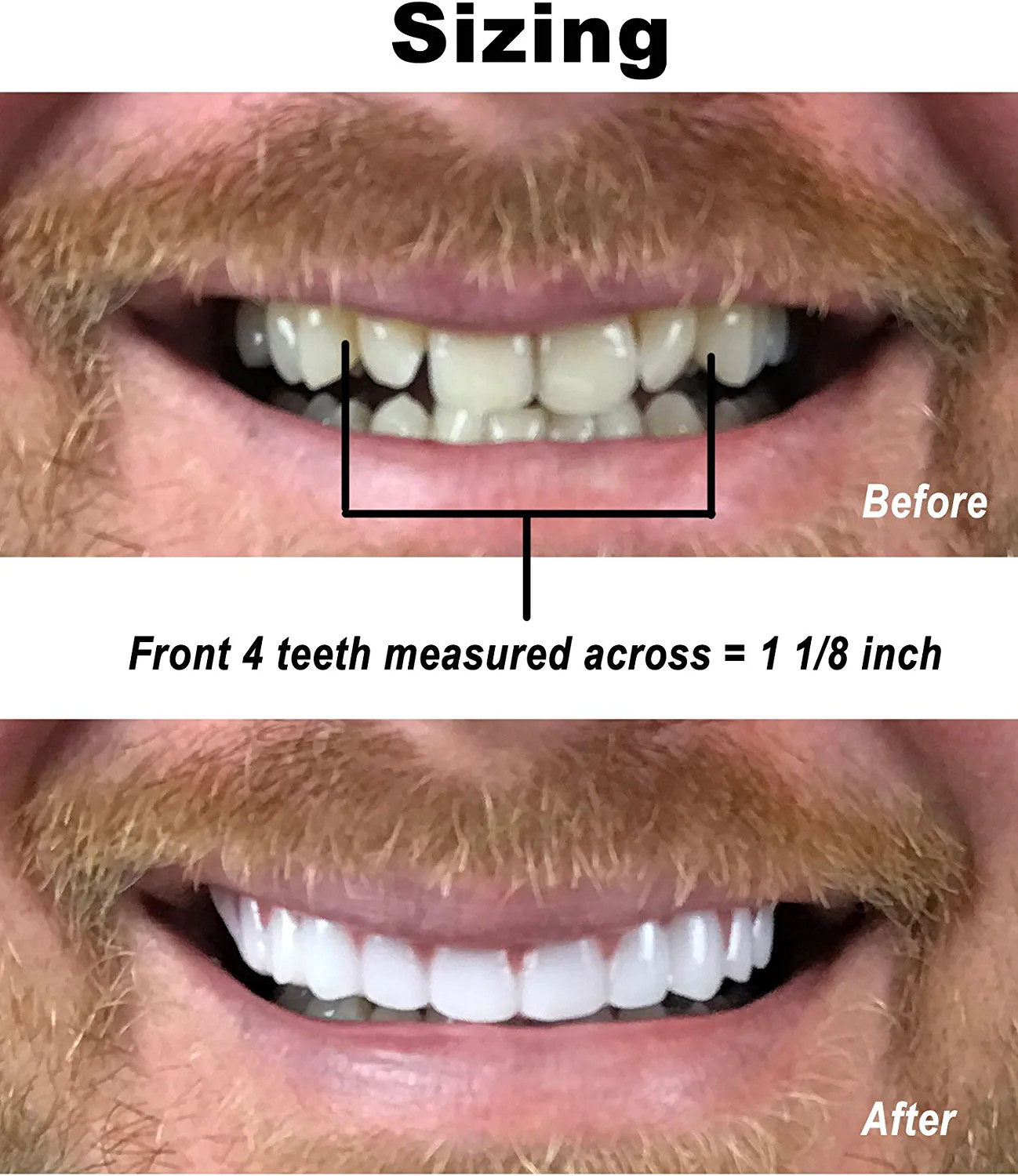 Instant Smile Comfort Fit Flex - Bright White - Upper Veneer Cosmetic Teeth