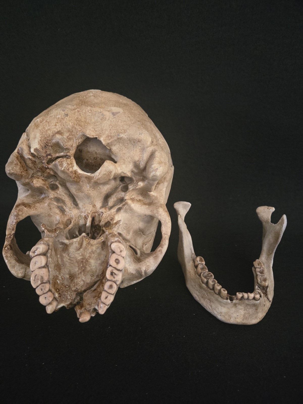 Human Skull Life Size Replica with battle wounds Realistic - Momento Mori