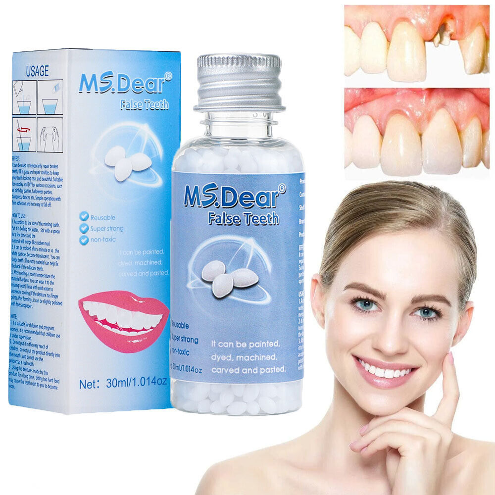 2× Tooth Repair Kit, Temporary Teeth Replacement Kit for Missing & Broken Teeth