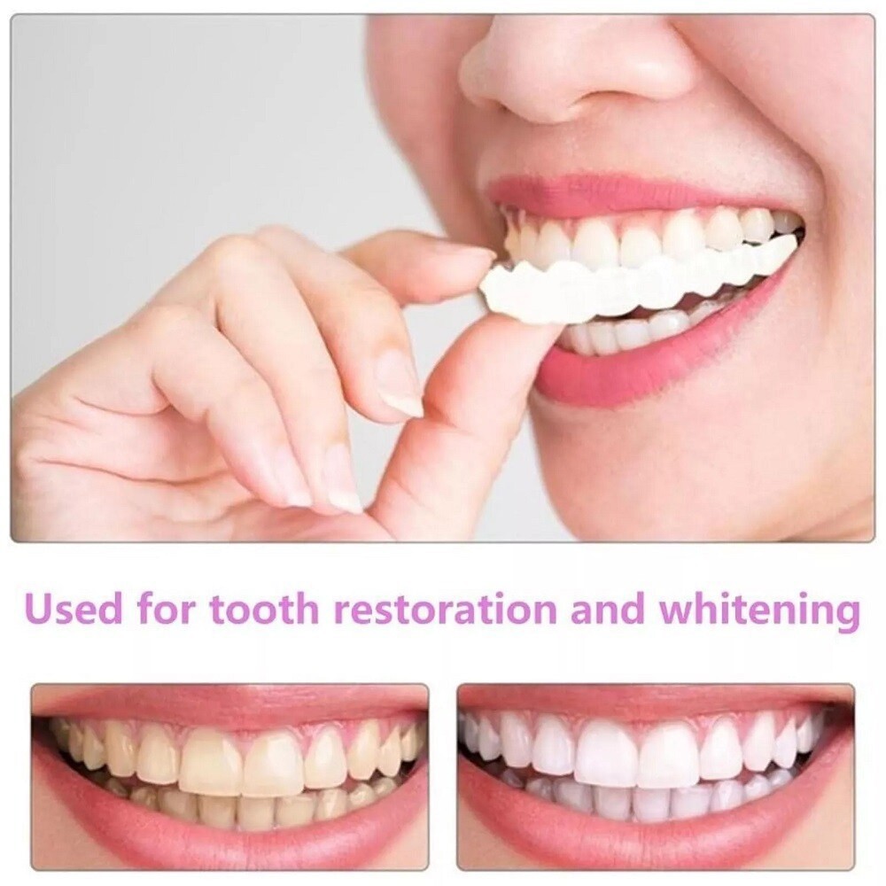 Snap On Upper＆Bottom Set False Teeth Dental Veneers Denture Tooth free shipping