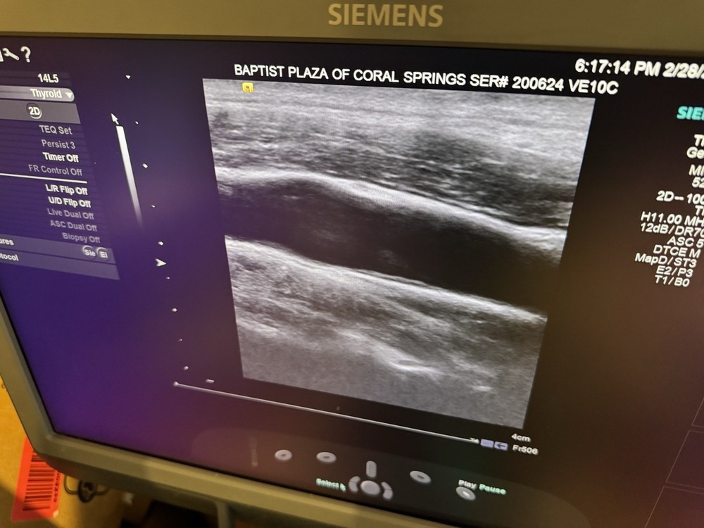 Siemens Acuson 14L5 Multi-D Transducer Probe