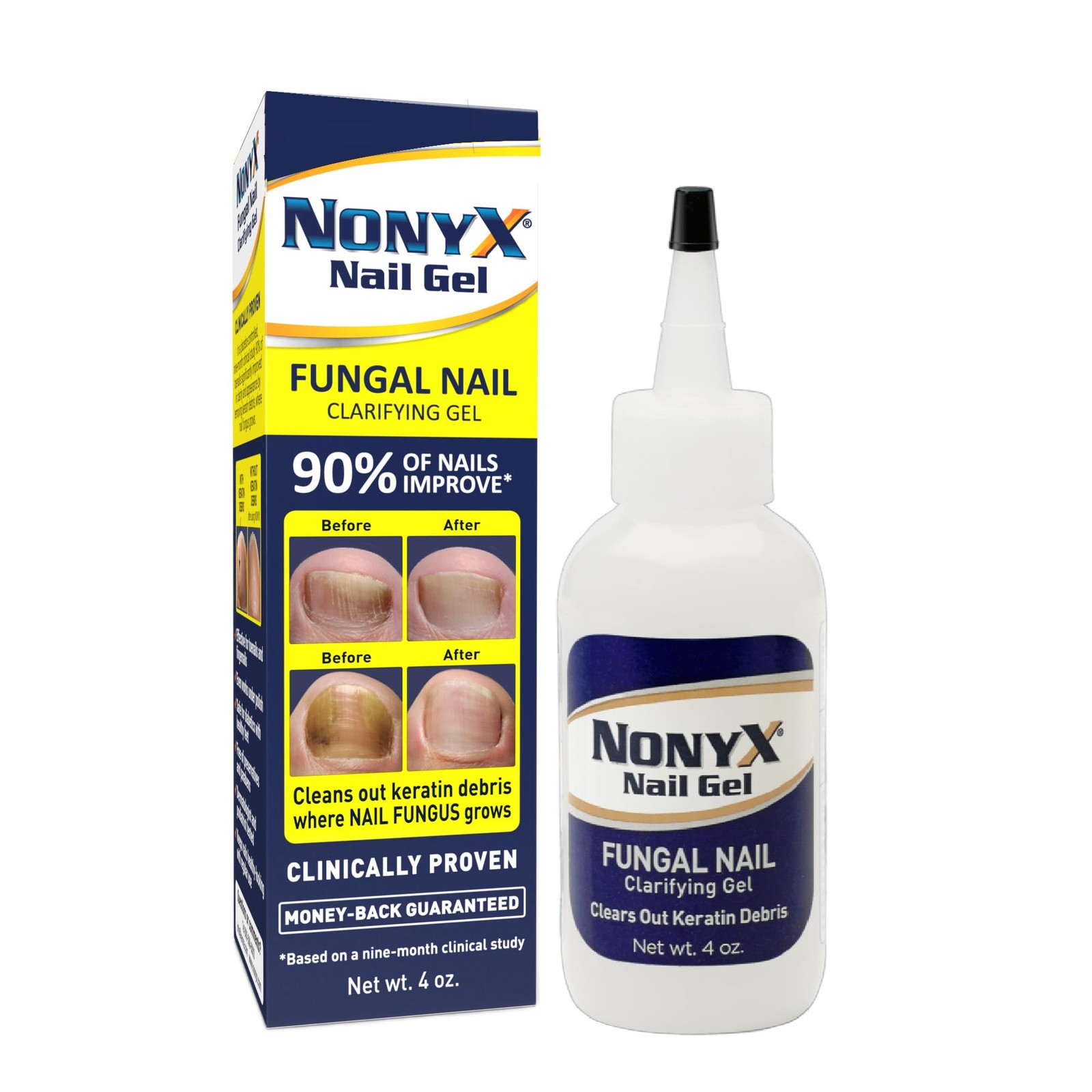 NONYX Fungal Nail Clarifying Gel - Discolored, Thick, Brittle Nails