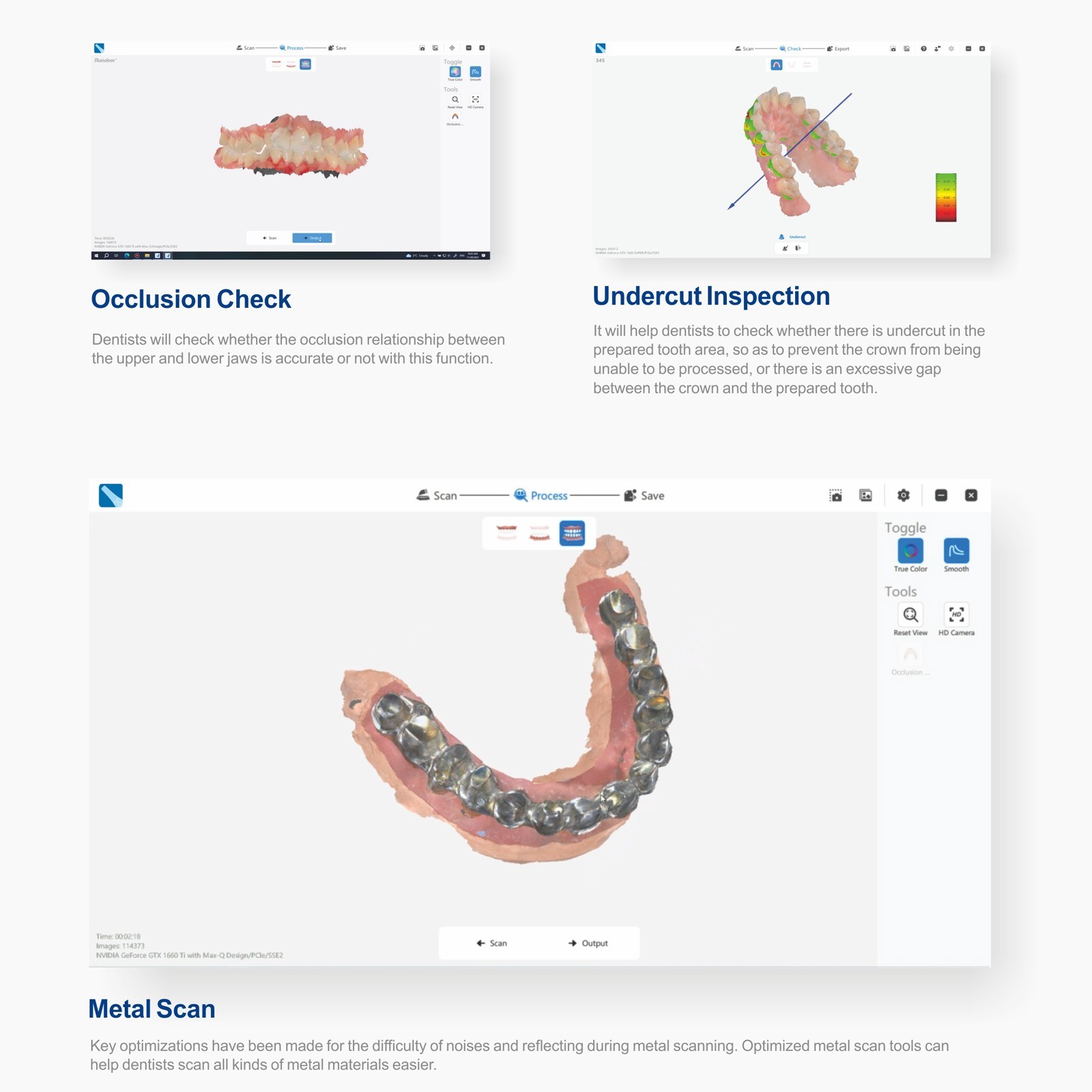 Dental Intra-oral 3D Scanner With Free Software CAD CMD