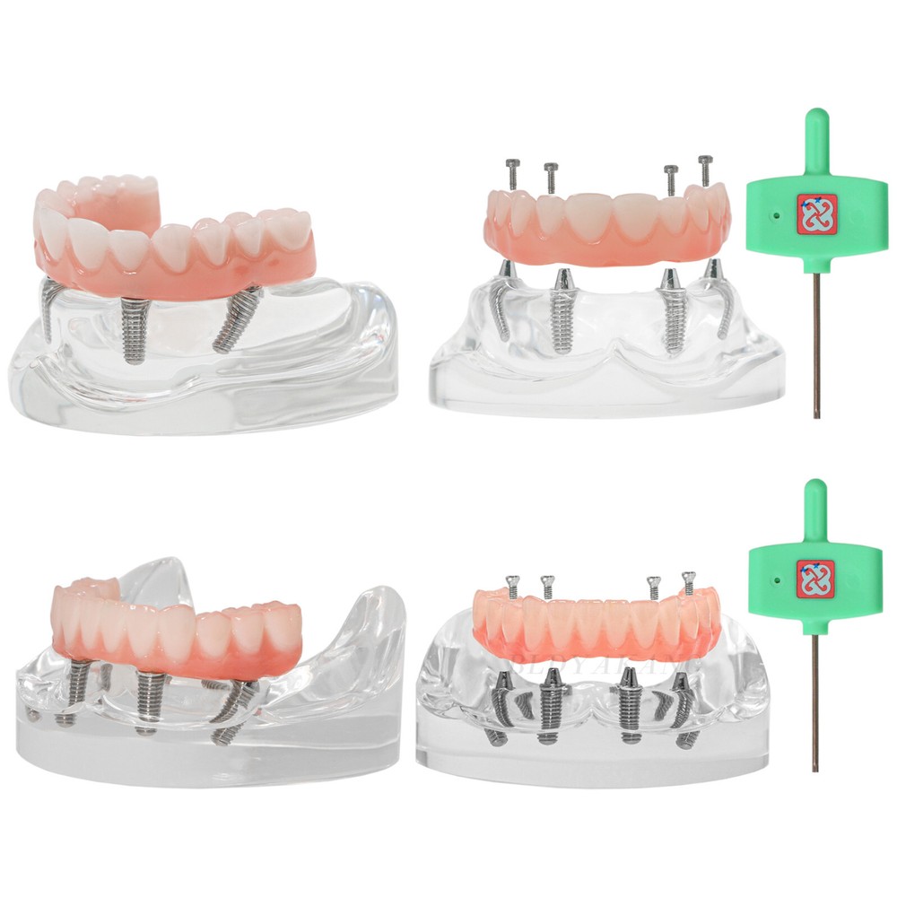 Multiple Types Dental Teeth Model Typodont Ortho Implant Practice Demo Teaching
