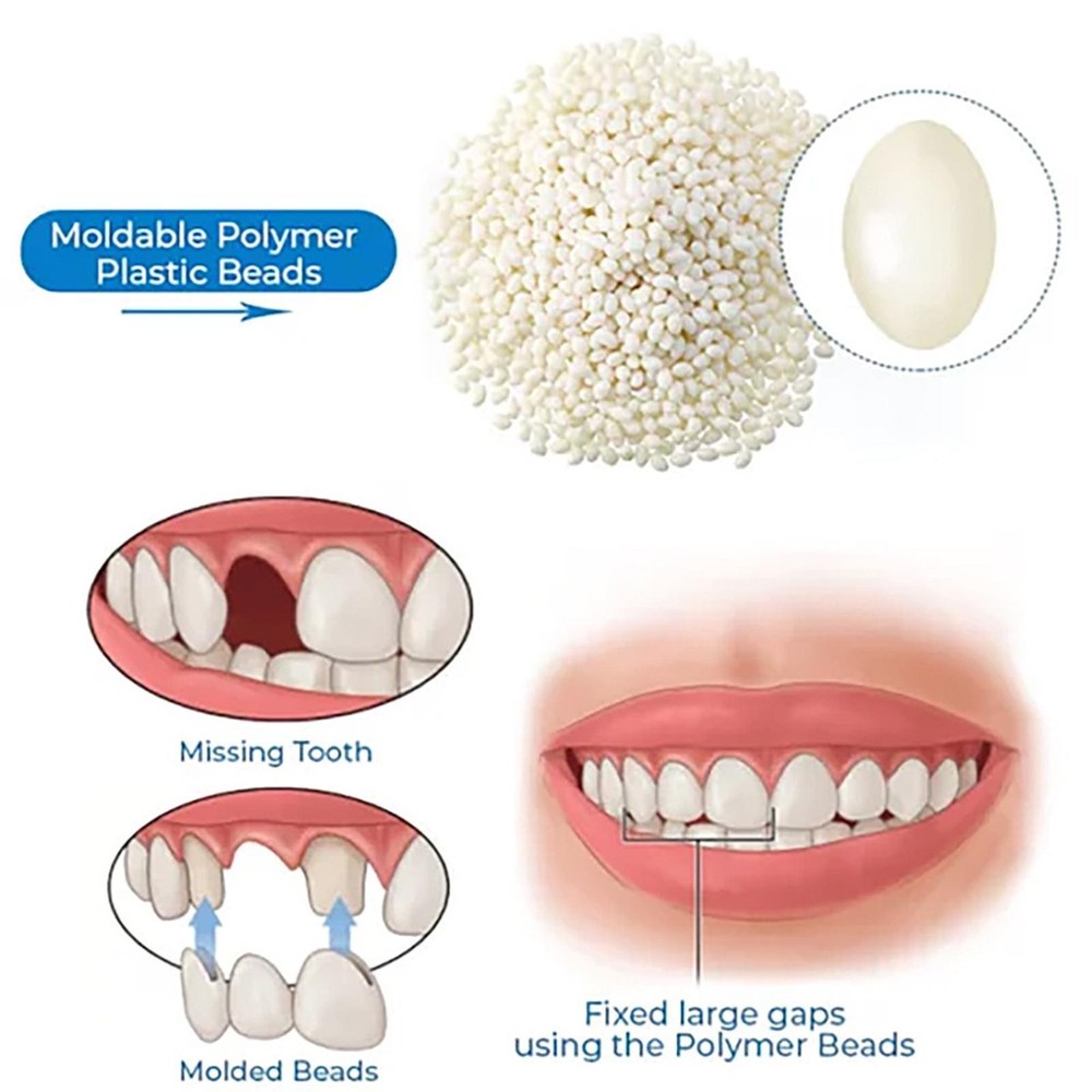 Moldable Teeth Repair Kit Temporary Dentals Replacement Kit Thermal