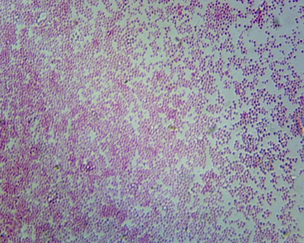 Escherichia Coli; Smear; Gram-Negative