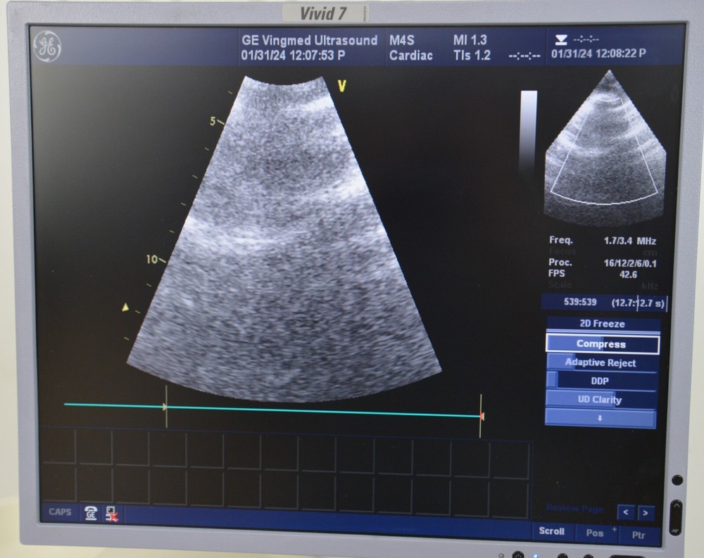 GE M4S Cardiac Sector Array 5129041