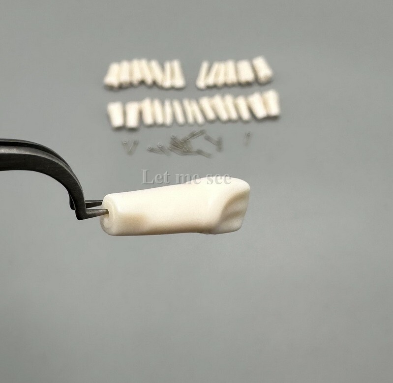 Dental Replacement Screw-in Teeth Typodont Models Study Practice Tooth Model