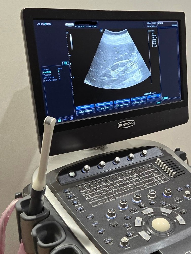 Alpinion ECube 9 Diamond w/ transducers