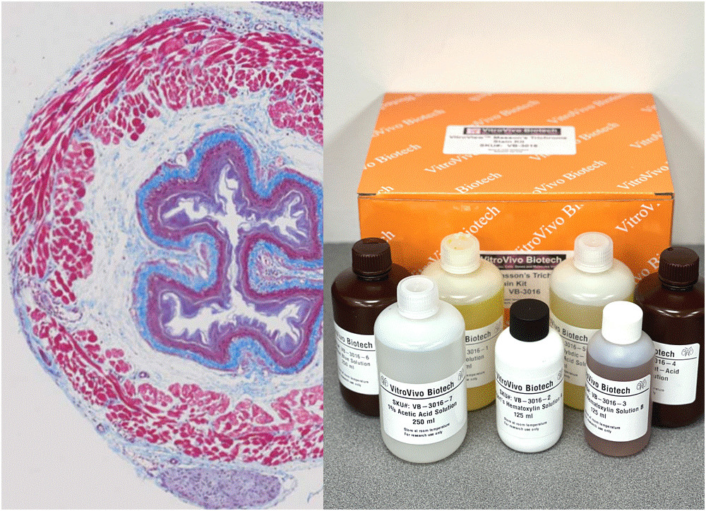 VitroView™ Masson’s Trichrome Stain Kit (Cat# VB-3016)