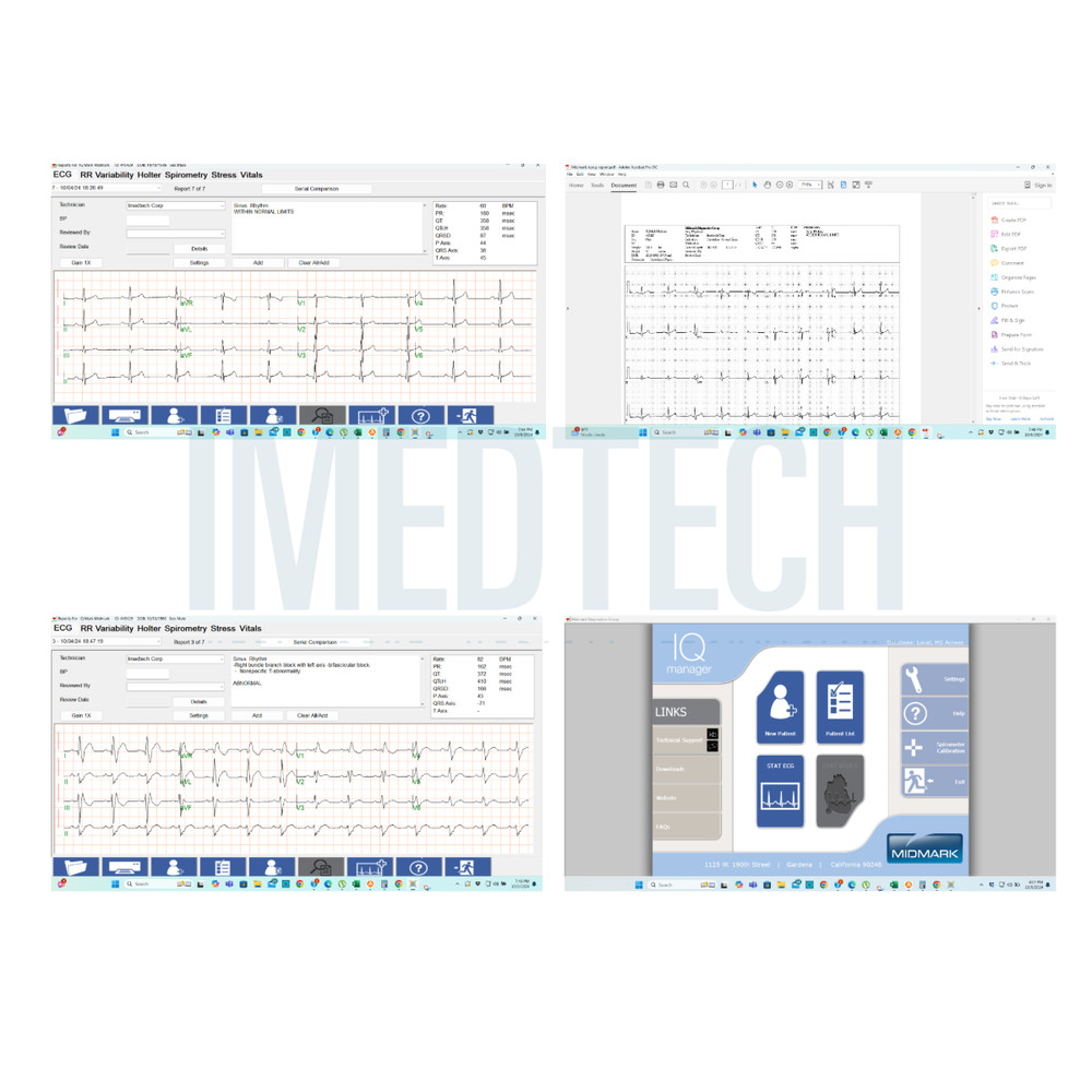 Midmark IQecg ECG Digital Interpretative eClinicalWorks Integration