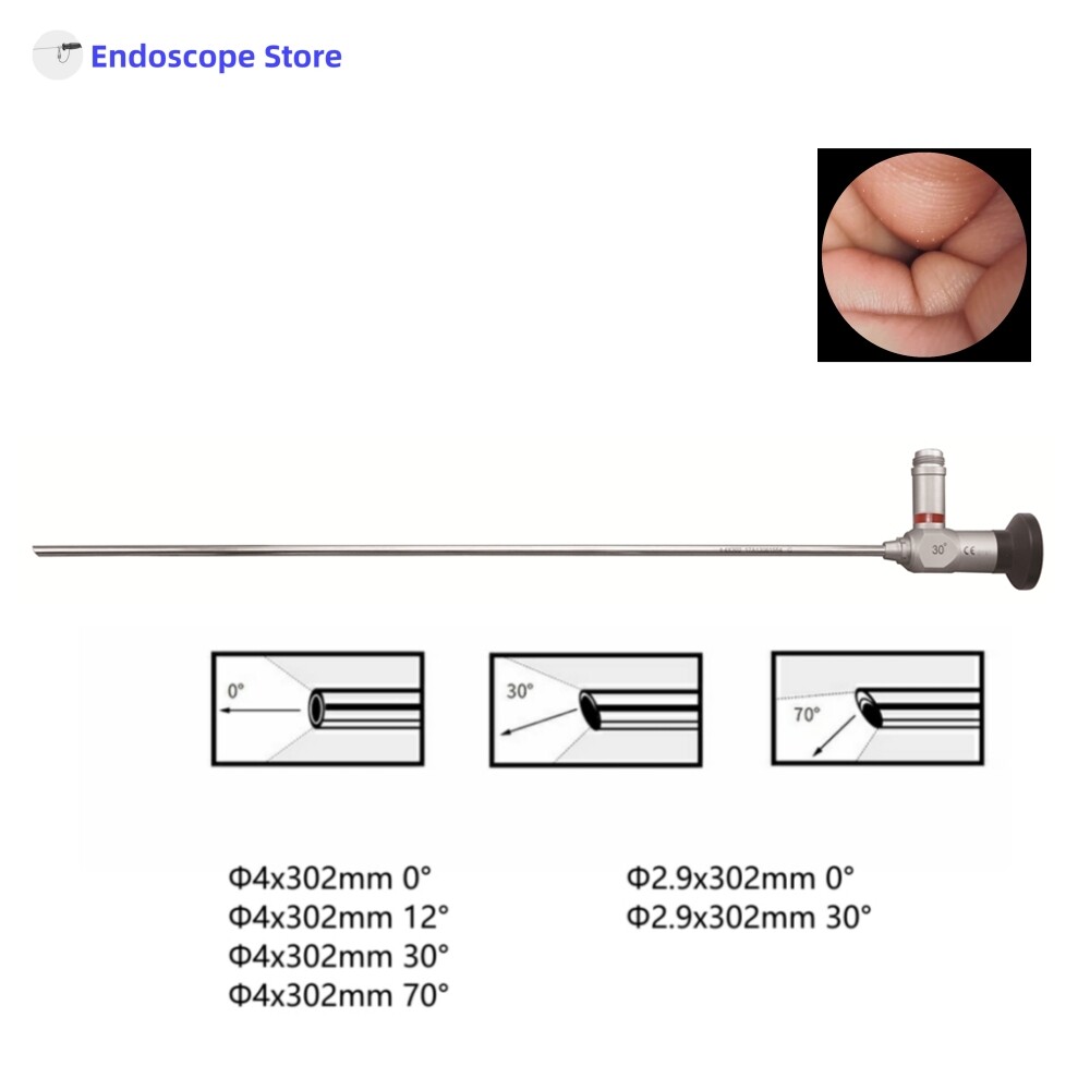 HD Medical Surgical Φ2.9mm Φ4mm  302mm 0° 12° 30°  70° Rigid Endoscope Optics