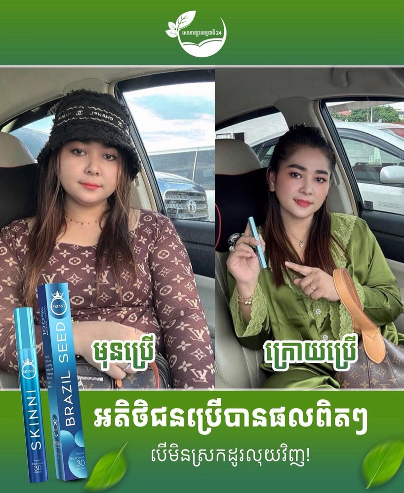 SKINNY Fast Slimគ្រាប់សម្រកធម្មជាតិ ស្គីននី ( 1ប្រអប់/ 30គ្រាប់ )