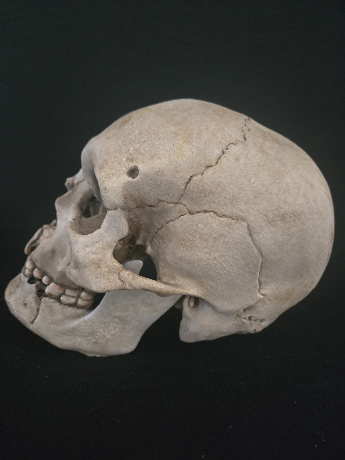 Human Skull Life Size Replica with battle wounds Realistic - Momento Mori