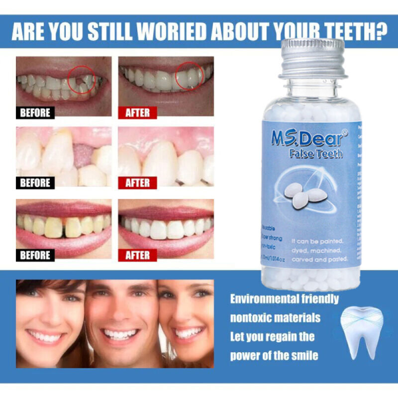 False Teeth Solid Glue Temporary Tooth Repair Moldable Fix Broke Gap Teeth 30ml