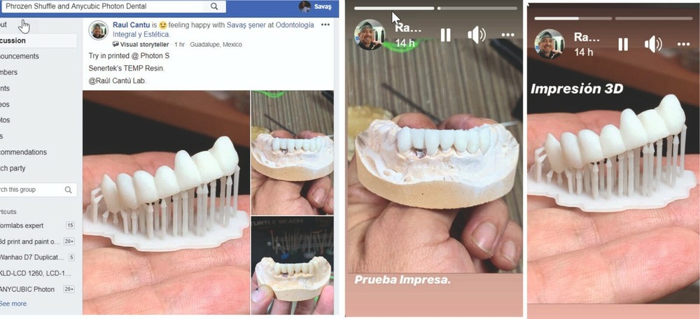 DLP SLA LCD 3d printer temporary teeth resin ..