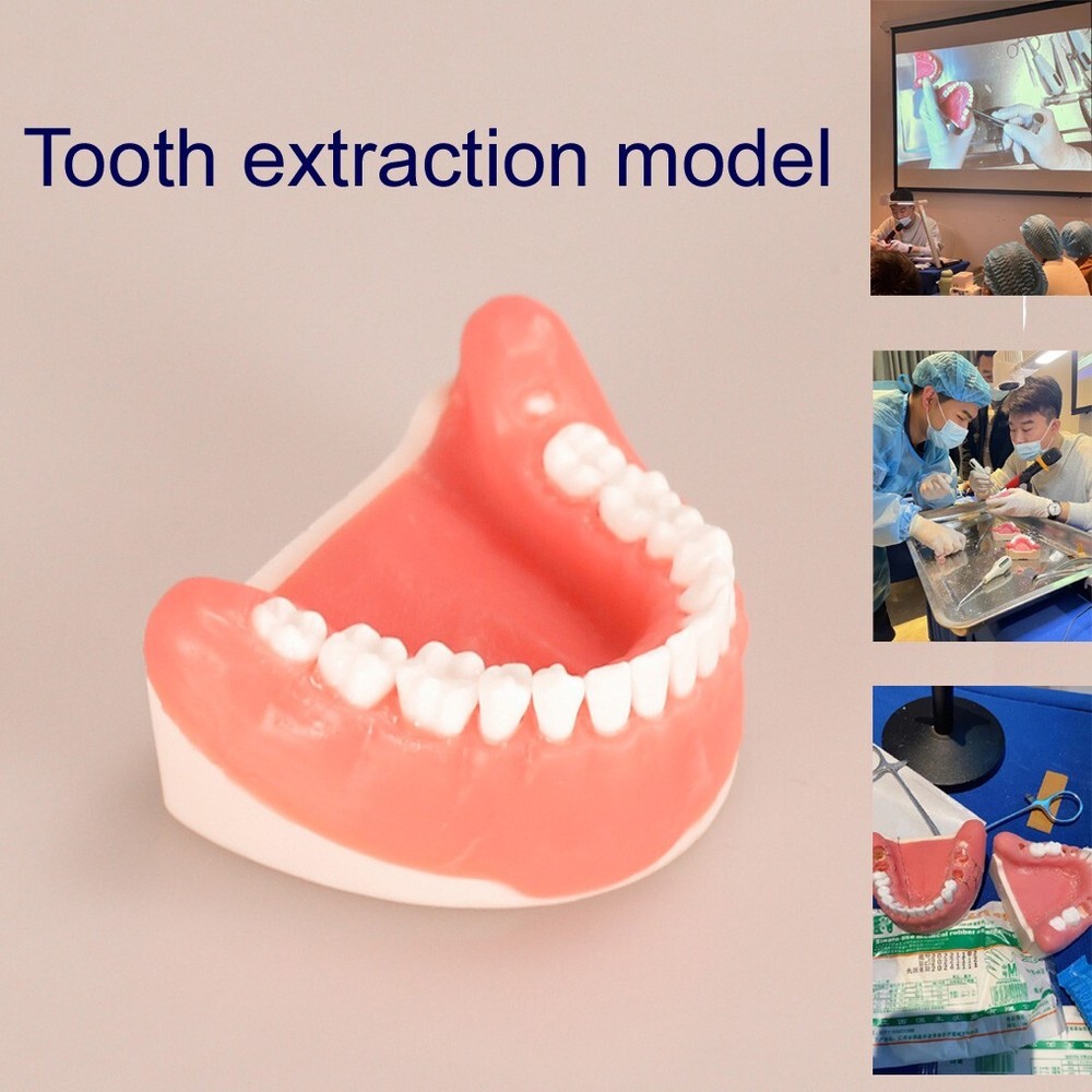 Maxillary+mandibular Tooth Extraction Practice Model Dental Typodont Teeth