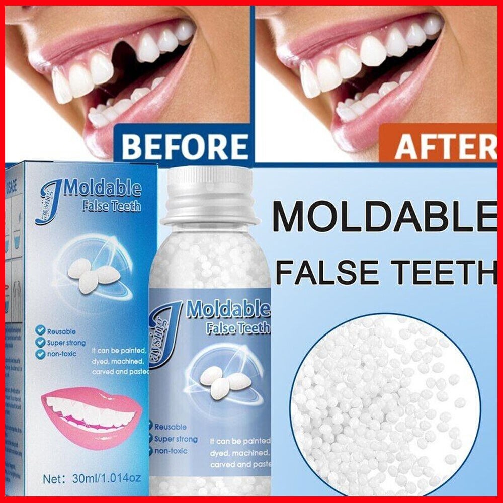 Tooth Repair Granules Temporary Kit Moldable False Teeth Fitting Beads Reusable
