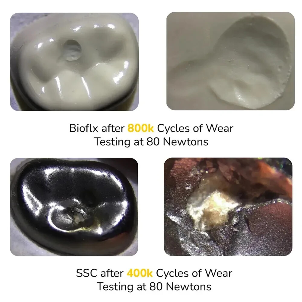 Kids-e-Dental BioFlx Upper Right 2nd Molar Crowns Refills