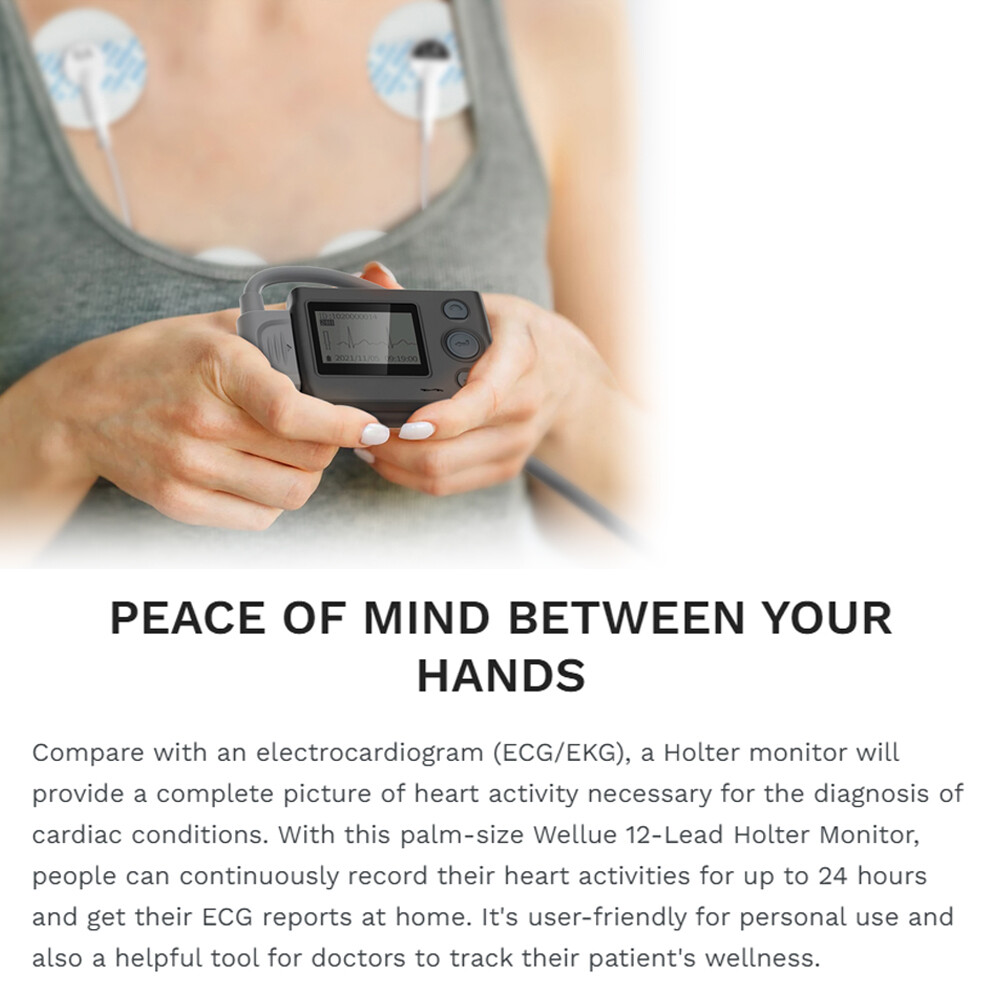 12 lead Holter Monitor 24h Portable with AI analysis software for Mac & Windows