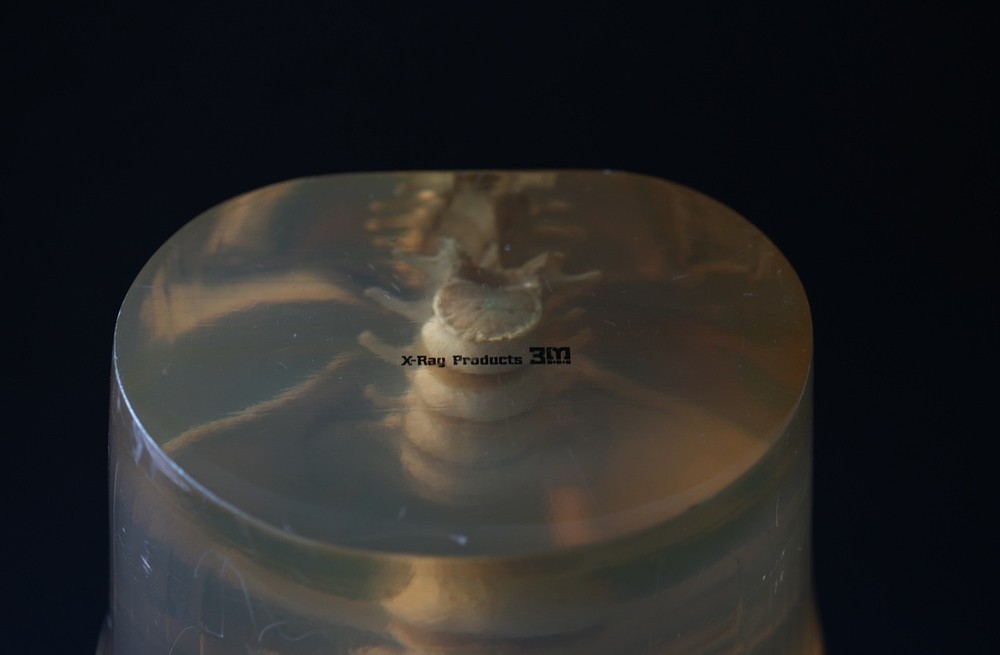 3M Xray Calibration Phantom Pelvis C.1960's