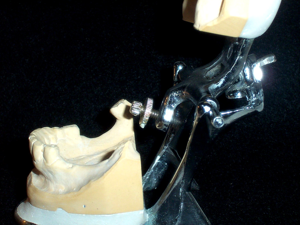 Overbite - Vintage Dental Articulated Model Teeth