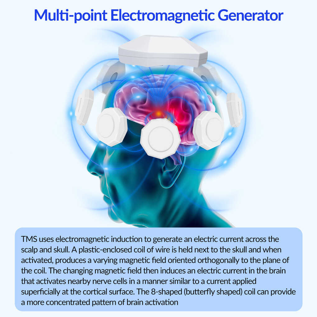 Transcranial Electromagnetic Treatment for Parkinsons Brain Recovery Headache