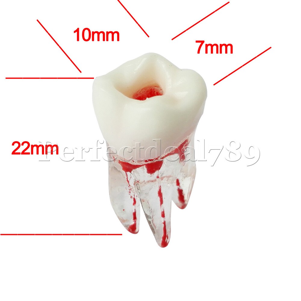 Dental Orthodontics Implant Study Model Analysis Demonstration Tooth Teaching