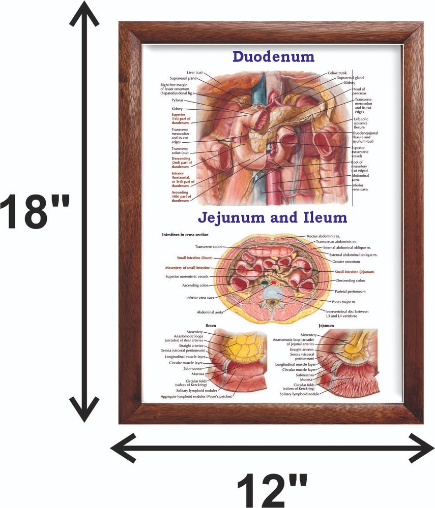 Duodenum Chart 12x18 inches