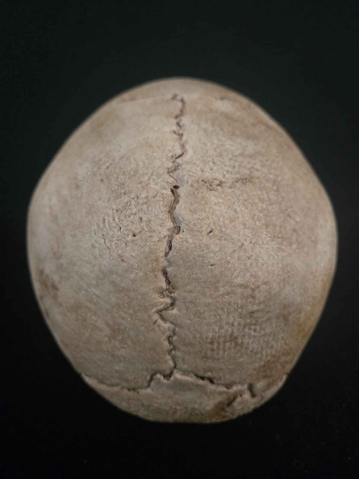 Human Skull Life Size Replica with battle wounds Realistic - Momento Mori