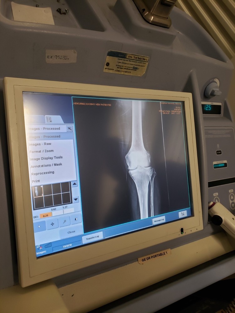 digital ray mobile machine GE AMX