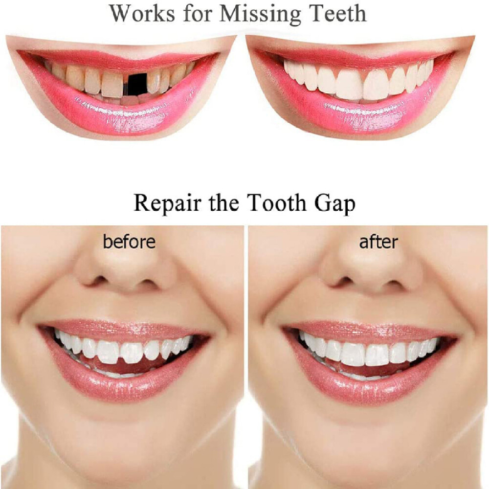 Temporary Tooth Repair Kit Temp Dental Repair Replace Missing Teeth DIY Moldable
