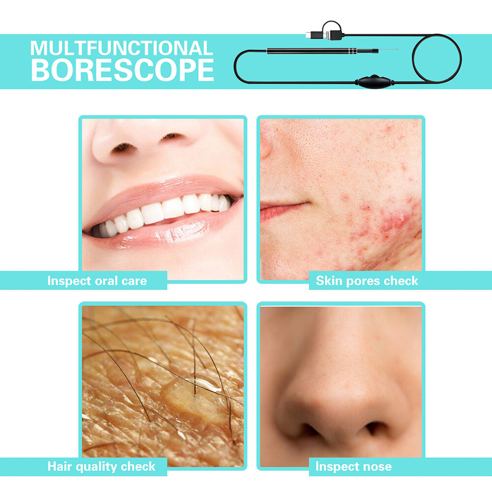 HD Ear Endoscope Otoscope LED Camera Tool Cleaning Wax Pick Cleaner Removal Kit