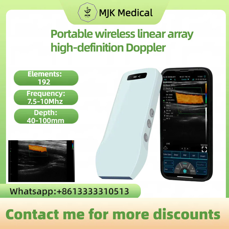 Portable Wireless Ultrasound Scanner - HD Linear Array Color Doppler