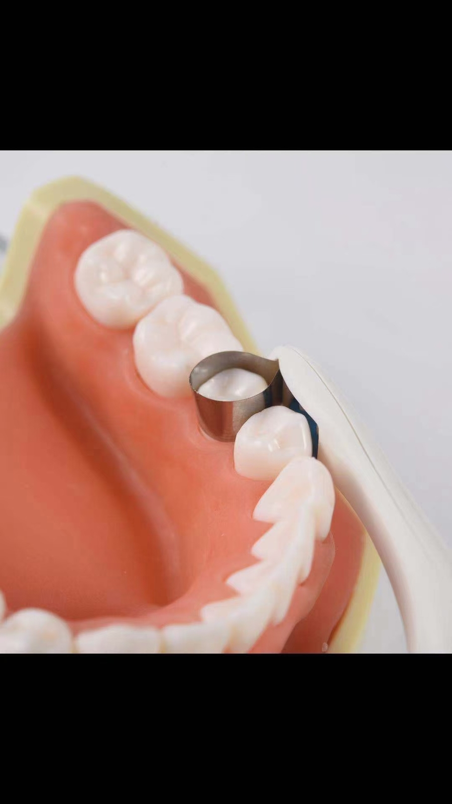 Adjust Dental Pro Matrix Bands Molar/Premolar Restoration Pre Formed 10/20/30Pcs